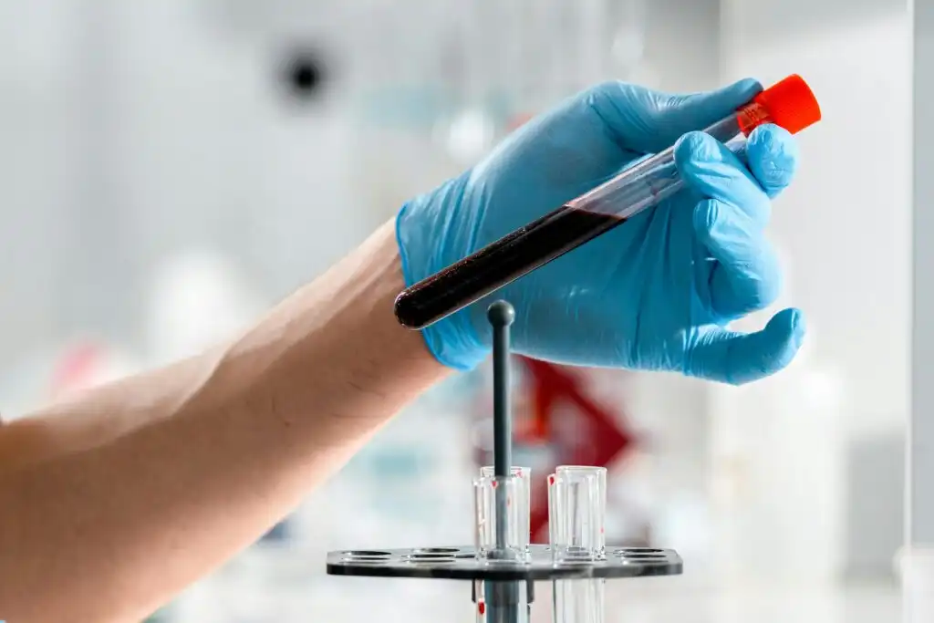 Laboratory technician handling a blood sample for biological analysis